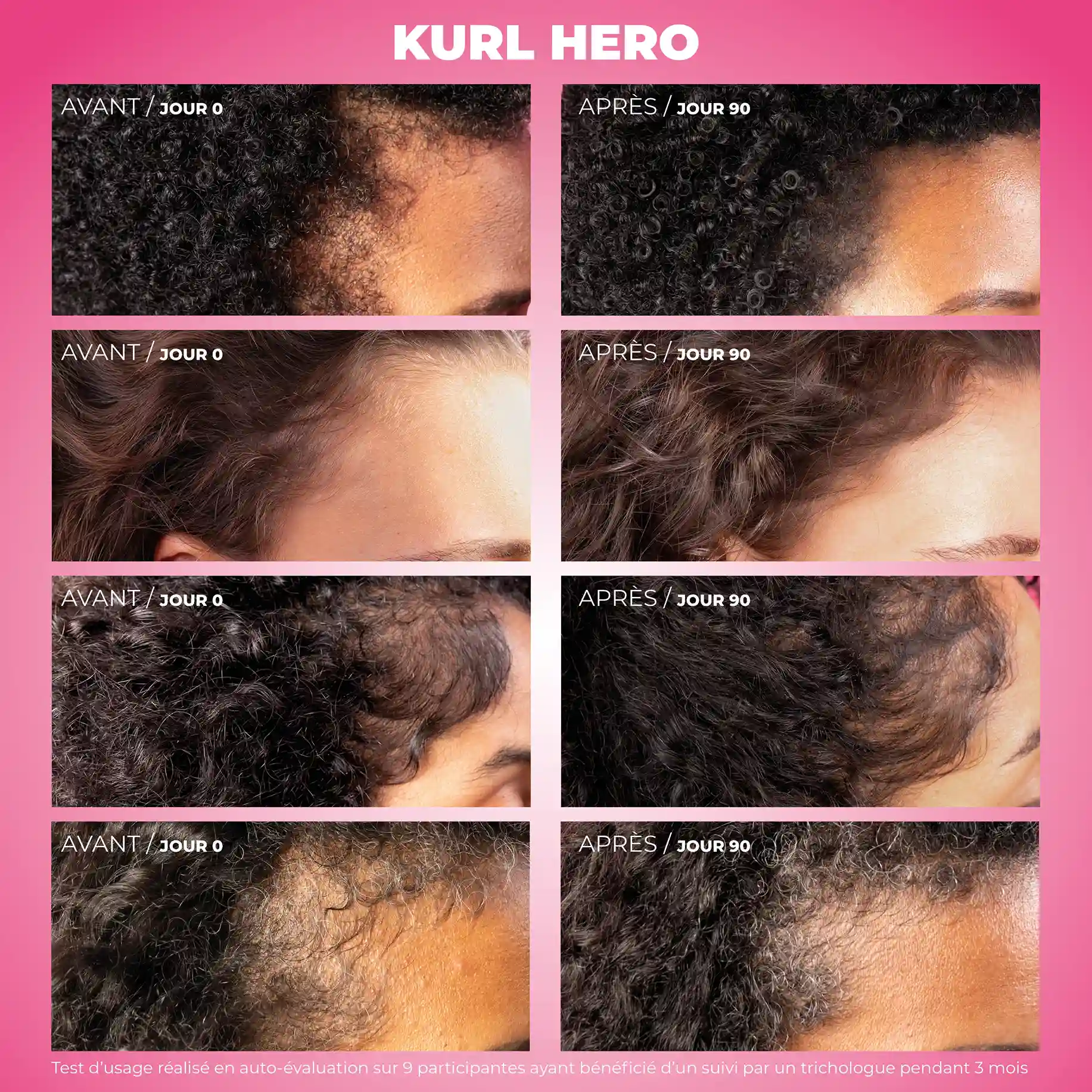 Duo Kurl Hero - Sérum anti-chute, croissance et densifiant & Dermaroller cuir chevelu - Image 5